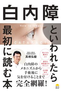 白内障といわれたら最初に読む本