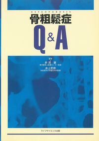 骨粗鬆症Q&A